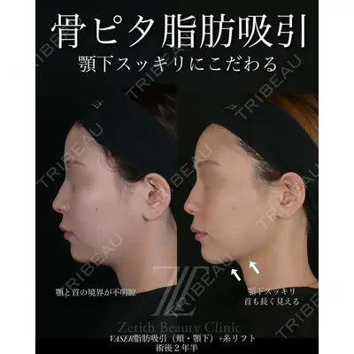 Zetith Beauty Clinic 池袋院 北村 翔医師の症例
