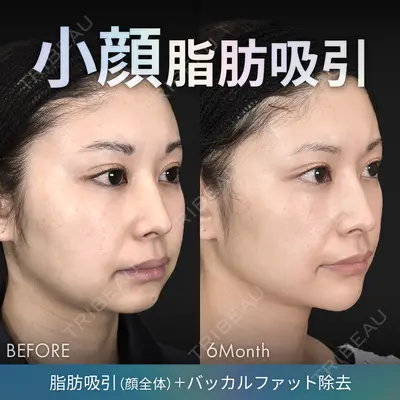 ジョウクリニック 銀座院 重本　譲医師の症例