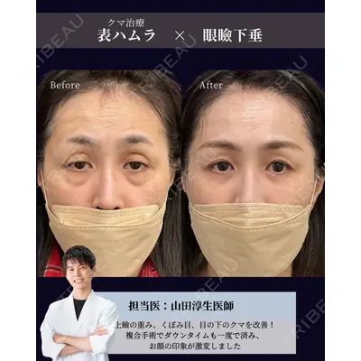 お茶の水美容形成クリニック 山田 淳生医師の症例