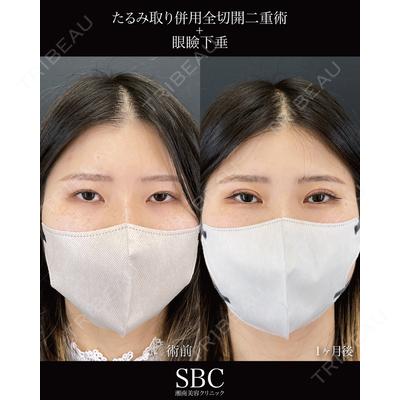 湘南美容クリニック 神戸三宮院 中川 卓医師の症例