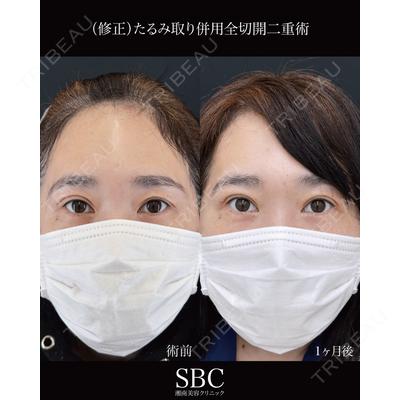 湘南美容クリニック 神戸三宮院 中川 卓医師の症例