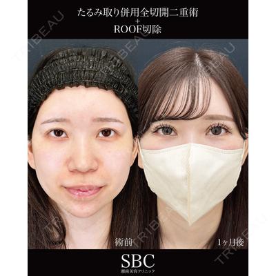 湘南美容クリニック 神戸三宮院 中川 卓医師の症例
