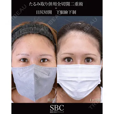 湘南美容クリニック 神戸三宮院 中川 卓医師の症例