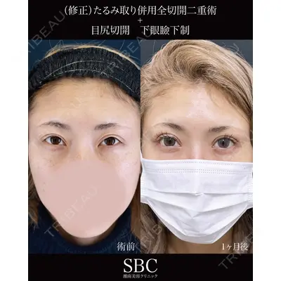 湘南美容クリニック 神戸三宮院 中川 卓医師の症例