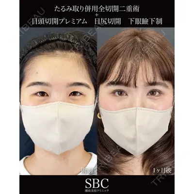 湘南美容クリニック 神戸三宮院 中川 卓医師の症例