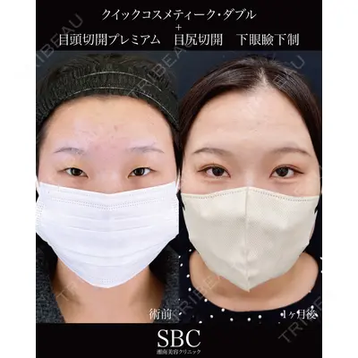 湘南美容クリニック 神戸三宮院 中川 卓医師の症例