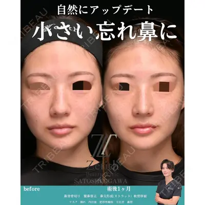 Zetith Beauty Clinic 銀座院 小川 悟史医師の症例