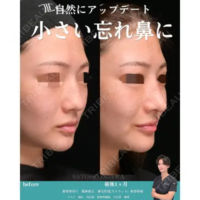 Zetith Beauty Clinic 銀座院 小川 悟史医師の症例