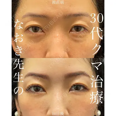 EMMO FACE CLINIC 大宮院 廣松 直樹医師の症例