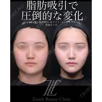 Zetith Beauty Clinic 池袋院 北村 翔医師の症例