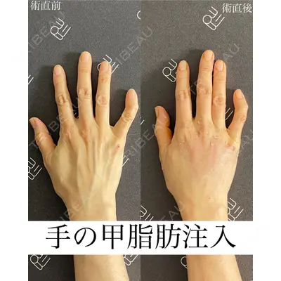 EMMO FACE CLINIC 大宮院 廣松 直樹医師の症例