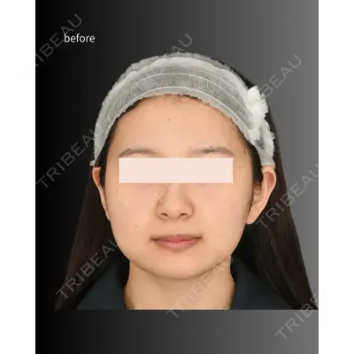 Lipo Clinic omotesando 福田 越医師の症例