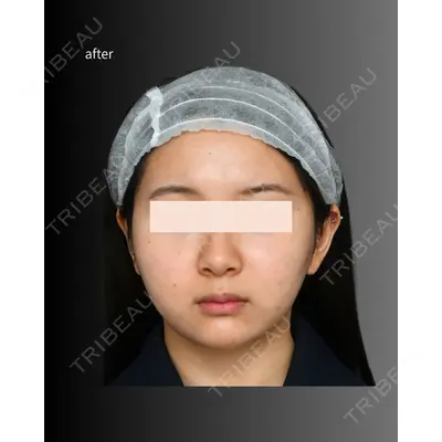 Lipo Clinic omotesando 福田 越医師の症例