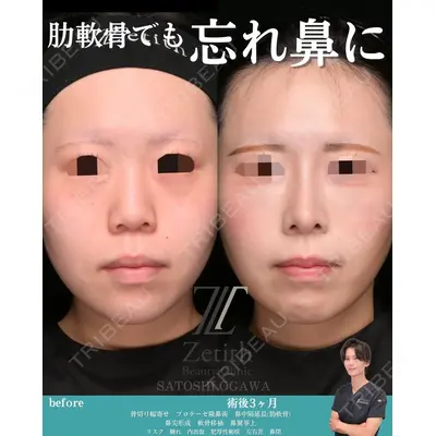 Zetith Beauty Clinic 銀座院 小川 悟史医師の症例
