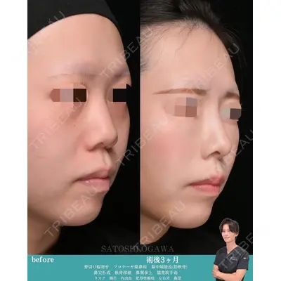 Zetith Beauty Clinic 銀座院 小川 悟史医師の症例