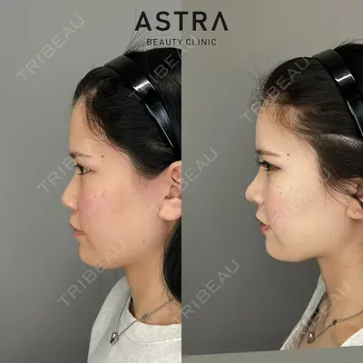 ASTRA BEAUTY CLINIC 塩満 惠子医師の症例