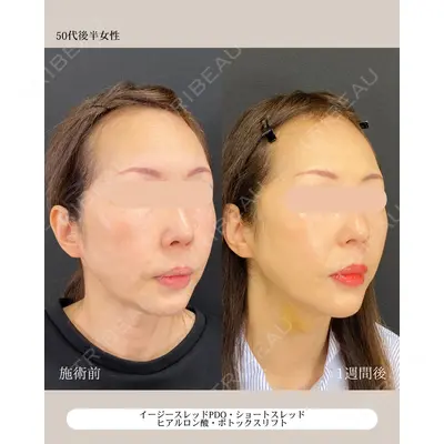 自由が丘ウェルエイジングビューティークリニック 福田 知佐子医師の症例