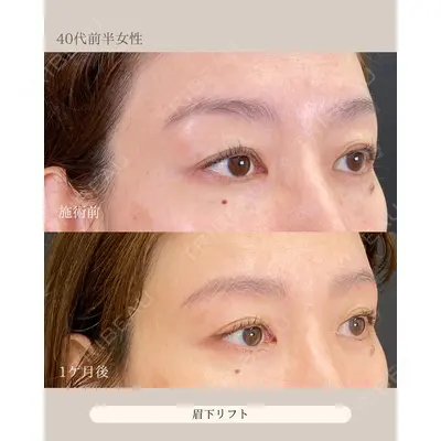 自由が丘ウェルエイジングビューティークリニック 福田 知佐子医師の症例