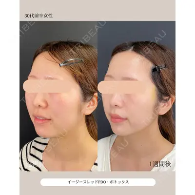 自由が丘ウェルエイジングビューティークリニック 福田 知佐子医師の症例