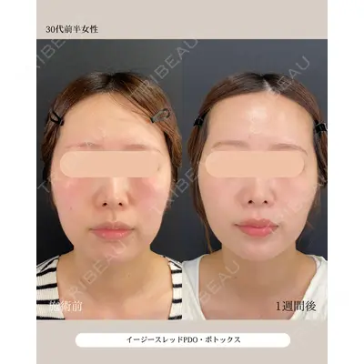 自由が丘ウェルエイジングビューティークリニック 福田 知佐子医師の症例
