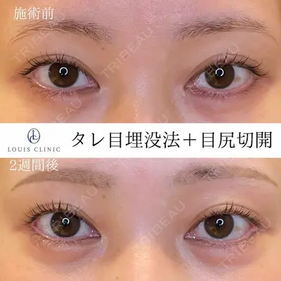 LOUIS CLINIC 二子玉川院【ルイクリニック】 小松 塁医師の症例