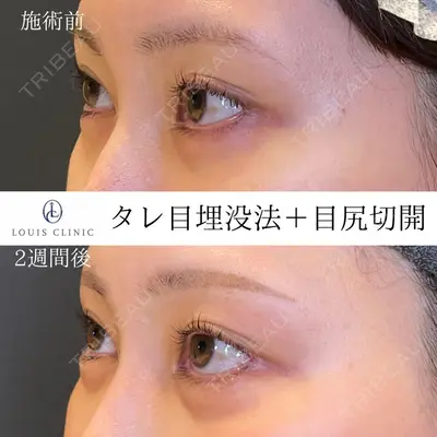 LOUIS CLINIC 二子玉川院【ルイクリニック】 小松 塁医師の症例