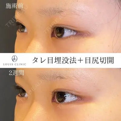LOUIS CLINIC 二子玉川院【ルイクリニック】 小松 塁医師の症例