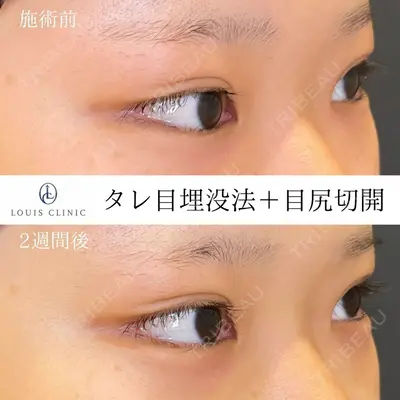LOUIS CLINIC 二子玉川院【ルイクリニック】 小松 塁医師の症例
