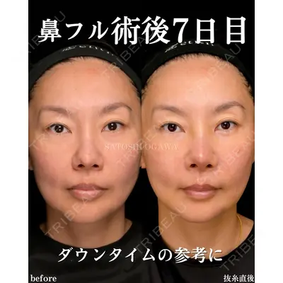 Zetith Beauty Clinic 銀座院 小川 悟史医師の症例