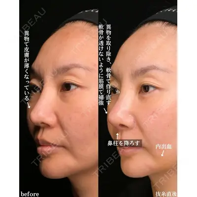 Zetith Beauty Clinic 銀座院 小川 悟史医師の症例
