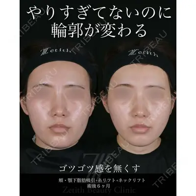 Zetith Beauty Clinic 池袋院 北村 翔医師の症例