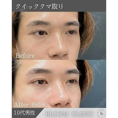 ブルームクリニック（BLOOM CLINIC） 大西 雅樹医師の症例