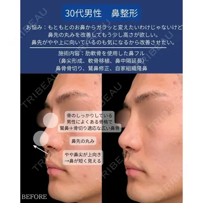 Zetith Beauty Clinic 銀座院 守屋 亜妃医師の症例
