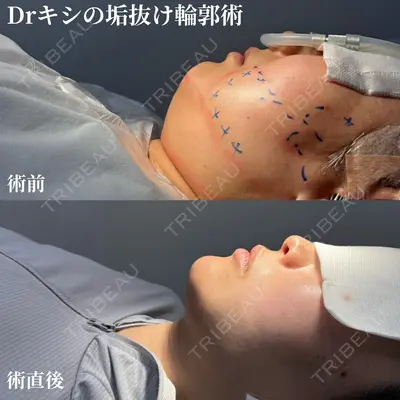 ネビュラクリニック 京都院 岸 大輔医師の症例