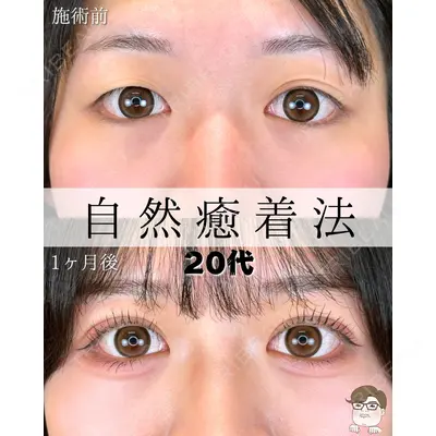 ルラ美容クリニック 札幌本院 佐藤 雄紀医師の症例