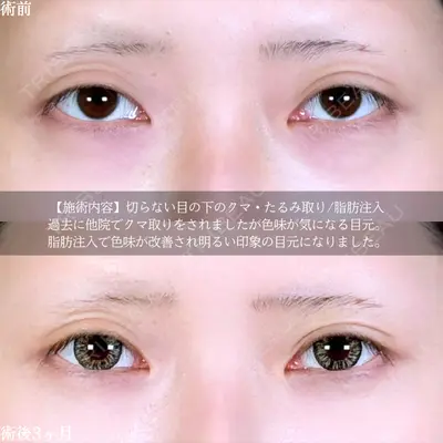アリエル美容クリニック 郡山院 安齋 誠基医師の症例