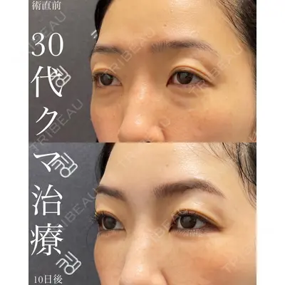 EMMO FACE CLINIC 大宮院 廣松 直樹医師の症例