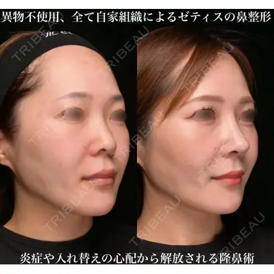 Zetith Beauty Clinic 大阪心斎橋院の症例