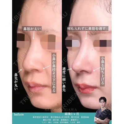 Zetith Beauty Clinic 銀座院 小川 悟史医師の症例