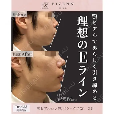 BIZENNクリニック【ビゼンクリニック】 小林 泰俊医師の症例