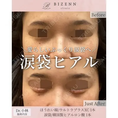 BIZENNクリニック【ビゼンクリニック】 小林 泰俊医師の症例