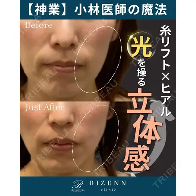 BIZENNクリニック【ビゼンクリニック】 小林 泰俊医師の症例