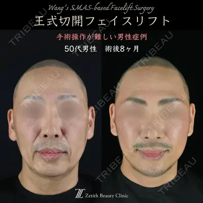 Zetith Beauty Clinic 新宿院の症例