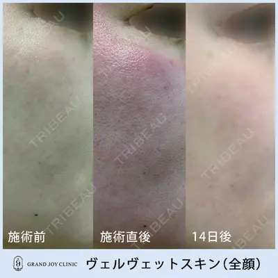 グランジョイクリニック 道上 育子医師の症例