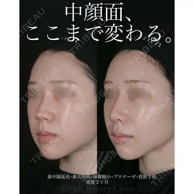 Zetith Beauty Clinic 池袋院 北村 翔医師の症例