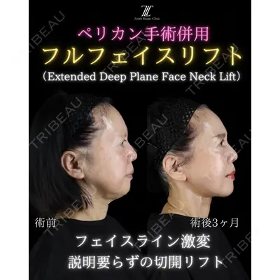Zetith Beauty Clinic 新宿院の症例