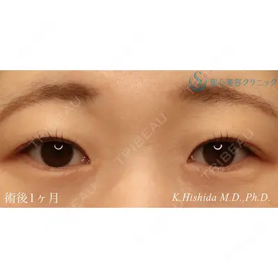聖心美容クリニック 六本木院 菱田 健作医師の症例