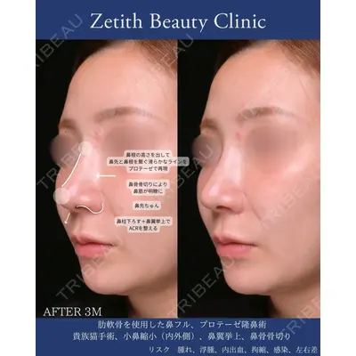 Zetith Beauty Clinic 銀座院 守屋 亜妃医師の症例