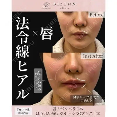 BIZENNクリニック【ビゼンクリニック】 小林 泰俊医師の症例