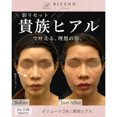 BIZENNクリニック【ビゼンクリニック】 小林 泰俊医師の症例
